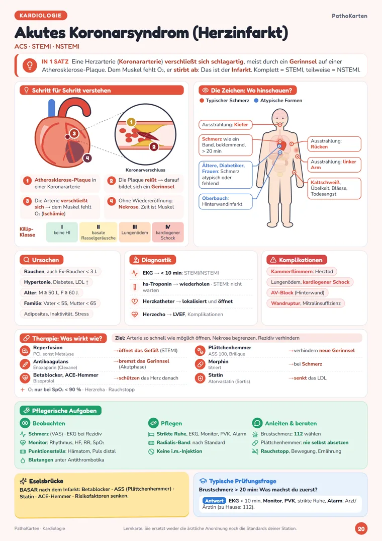 Karte Akutes Koronarsyndrom (ACS) von PathoKarten